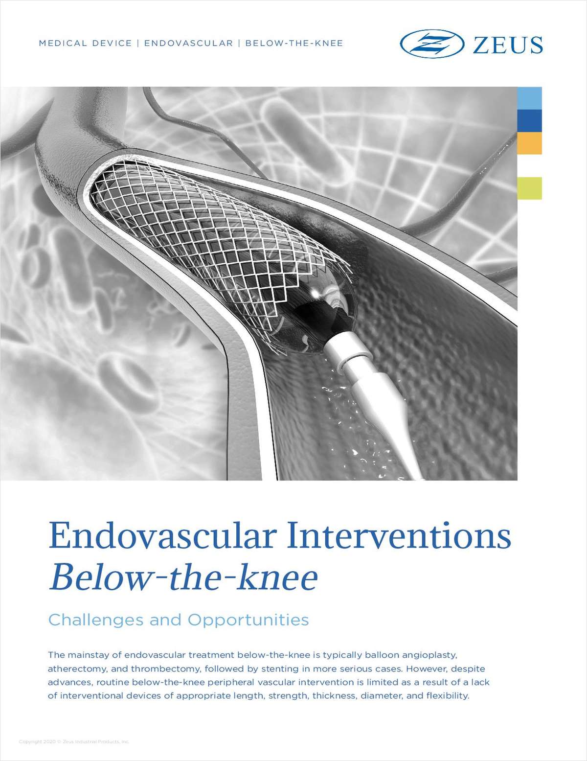 Endovascular Interventions: Treating PAD Below the Knee