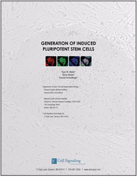 Generation of Induced Pluripotent Stem Cells