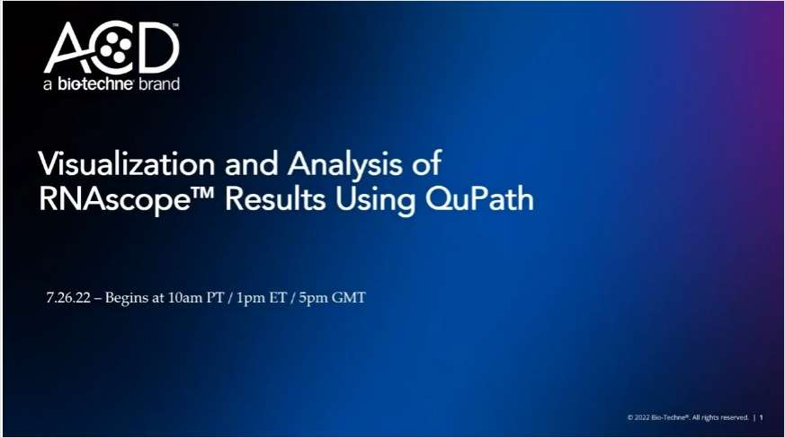 Visualization and Analysis of RNAscope Results using QuPath