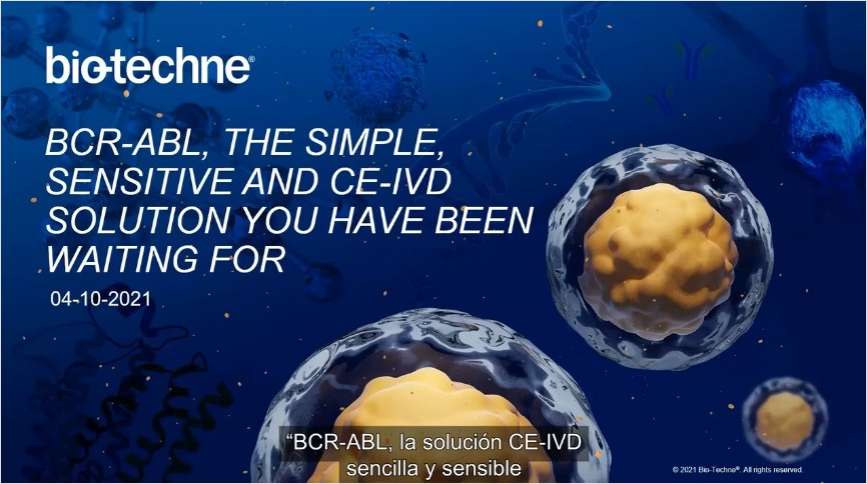 QuantideX, qPCR BCR-ABL The Simple, Sensitive, and CE-IVD Solution You Have Been Waiting For