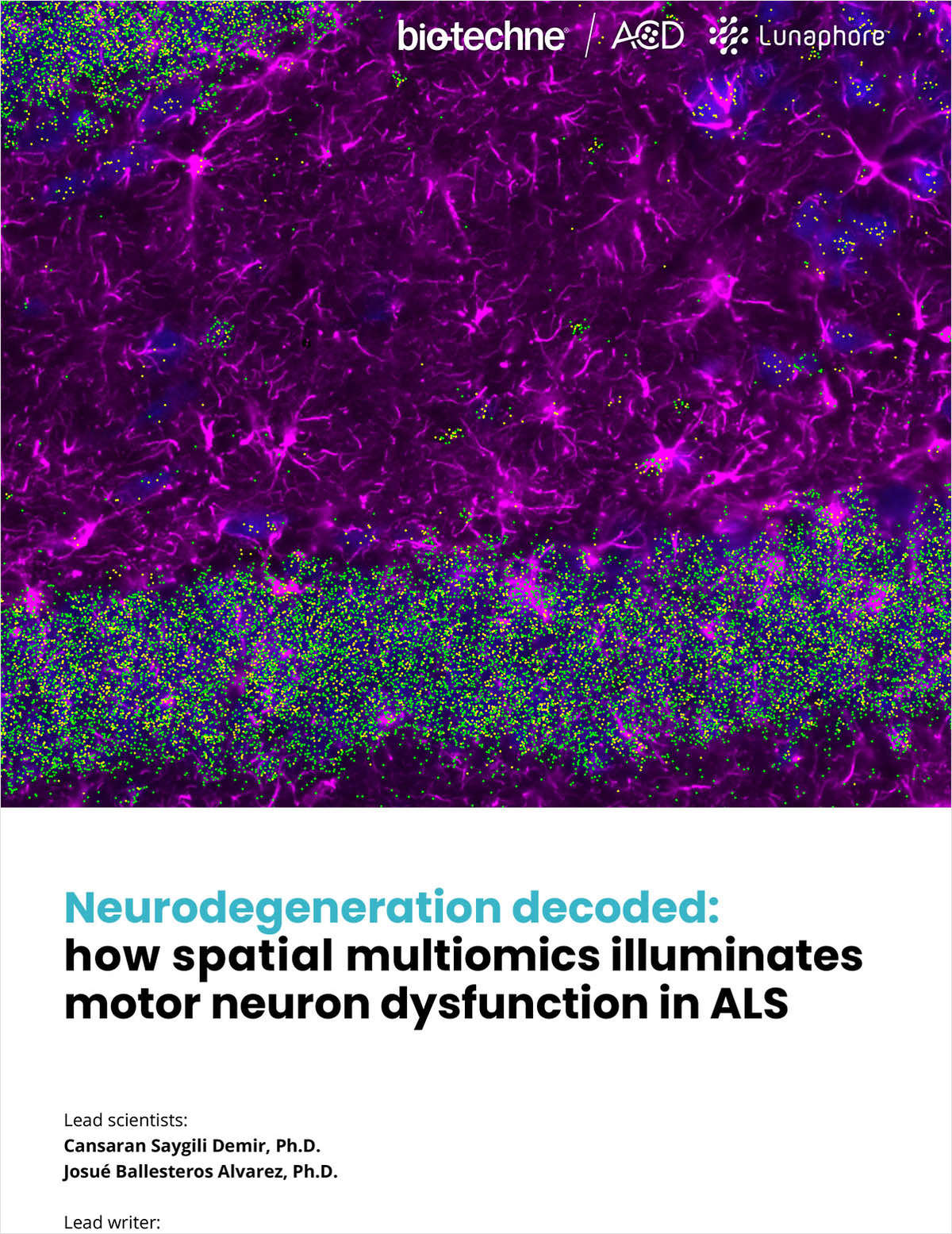 Decoding Neurodegeneration with Spatial Multiomics