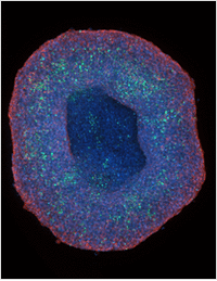 A Clear Look at 3D Spheroids: Imaging Breakthroughs in Cancer Research
