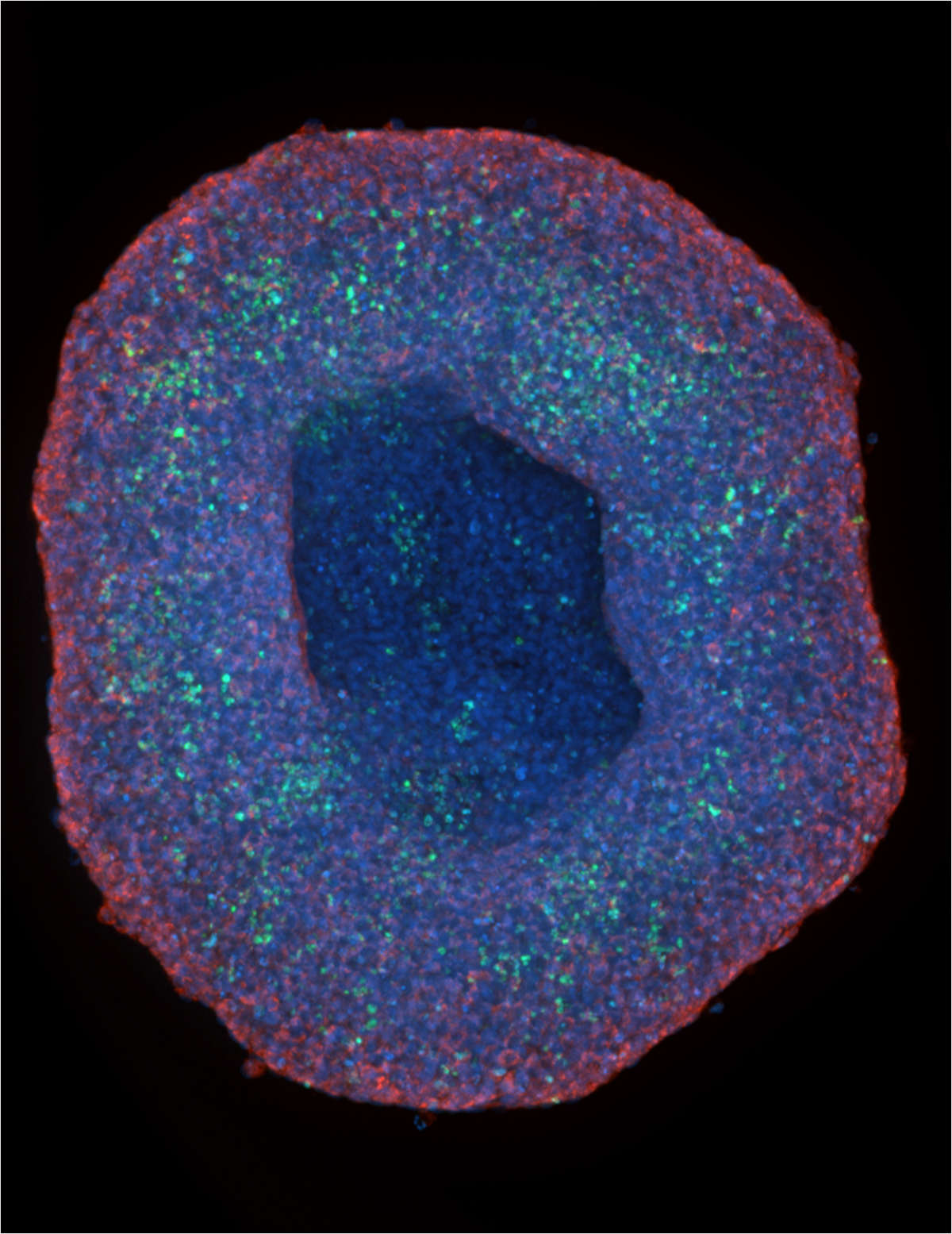 A Clear Look at 3D Spheroids: Imaging Breakthroughs in Cancer Research