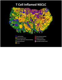 Overcoming the challenges of spatial biology with AI