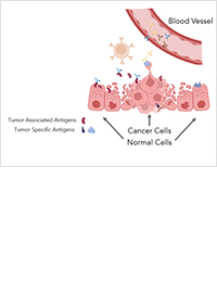 Autoantibodies: Powerful Biomarkers in Cancer Precision Medicine