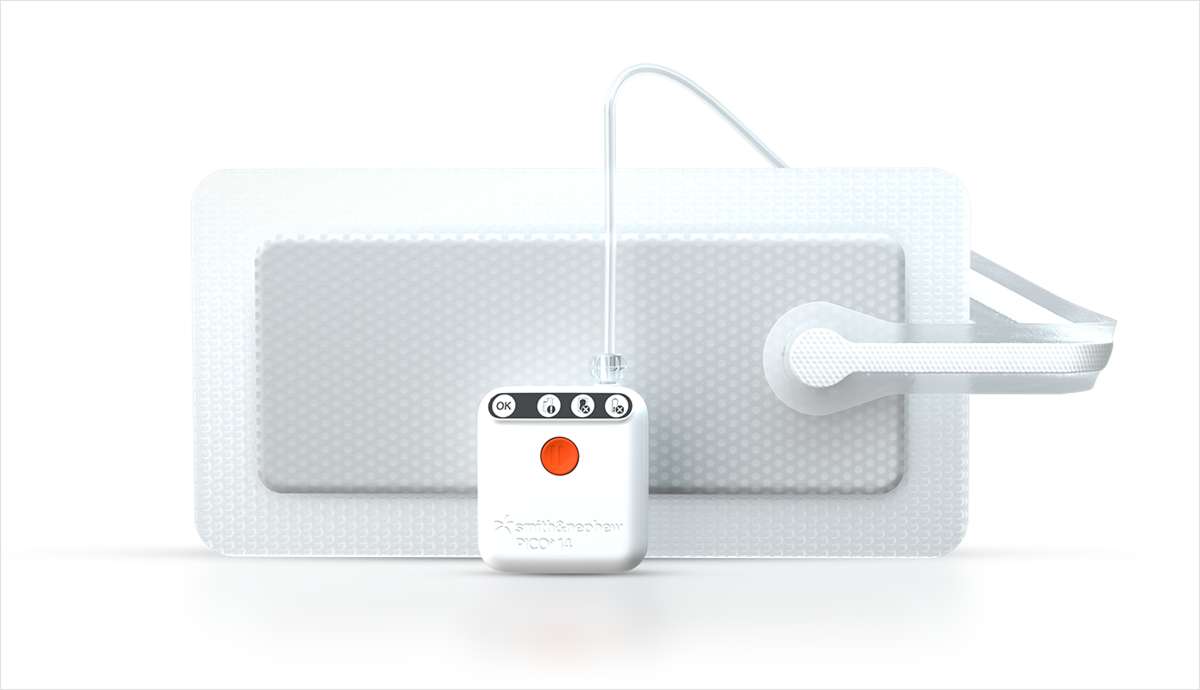 Comparative sNPWT Study Reveals Clinical and Economic Insights