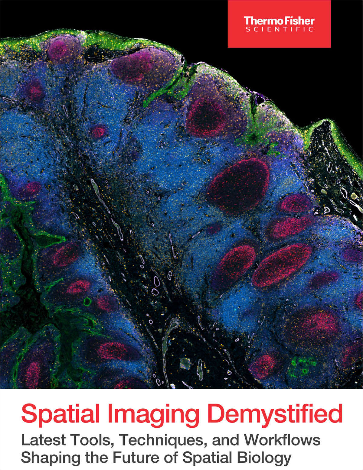 Spatial Imaging Demystified