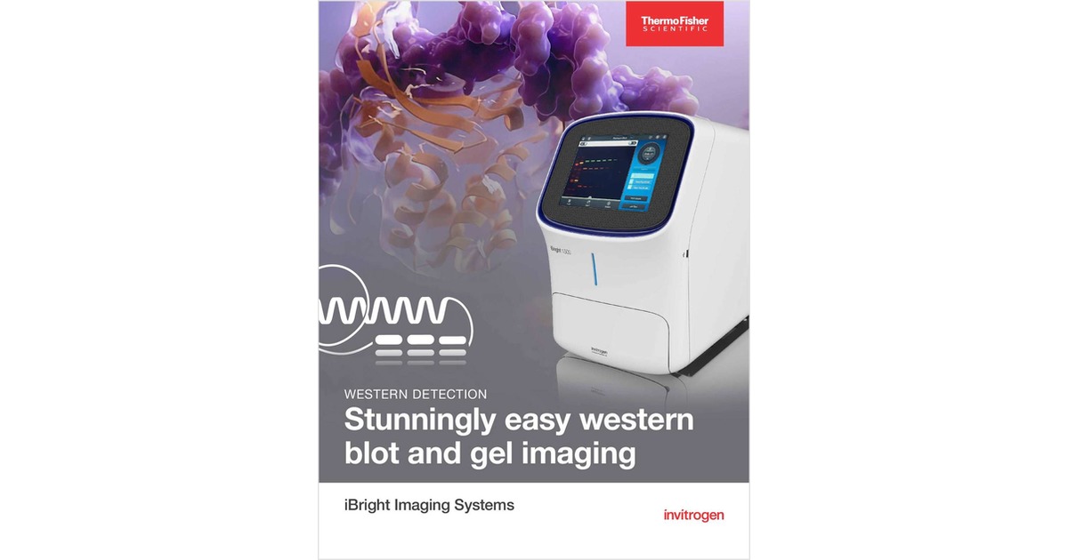 Stunningly Easy Western Blot and Gel Imaging Free Brochure